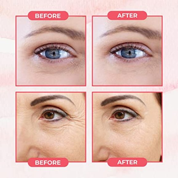 Retinol Eye Stick, Retinol Eye Cream for Dark Circles and Puffiness, Visible Res - Picture 5 of 5